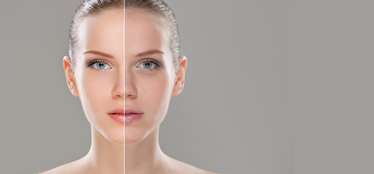 Bellezza Di Bader 9 Bellezza Di Bader -Bellezza Di Bader img20170526011343472